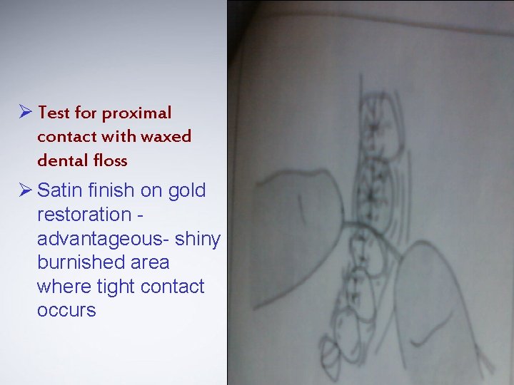 Ø Test for proximal contact with waxed dental floss Ø Satin finish on gold