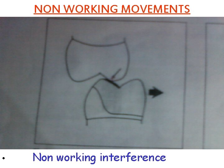 NON WORKING MOVEMENTS • Non working interference 