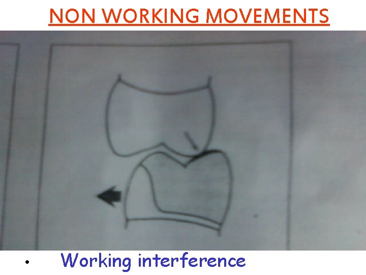 NON WORKING MOVEMENTS • Working interference 