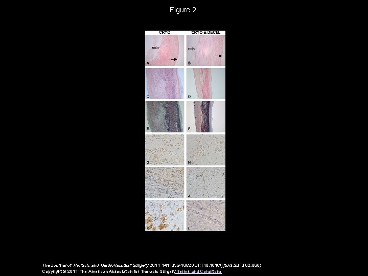 Figure 2 The Journal of Thoracic and Cardiovascular Surgery 2011 1411056 -1062 DOI: (10.