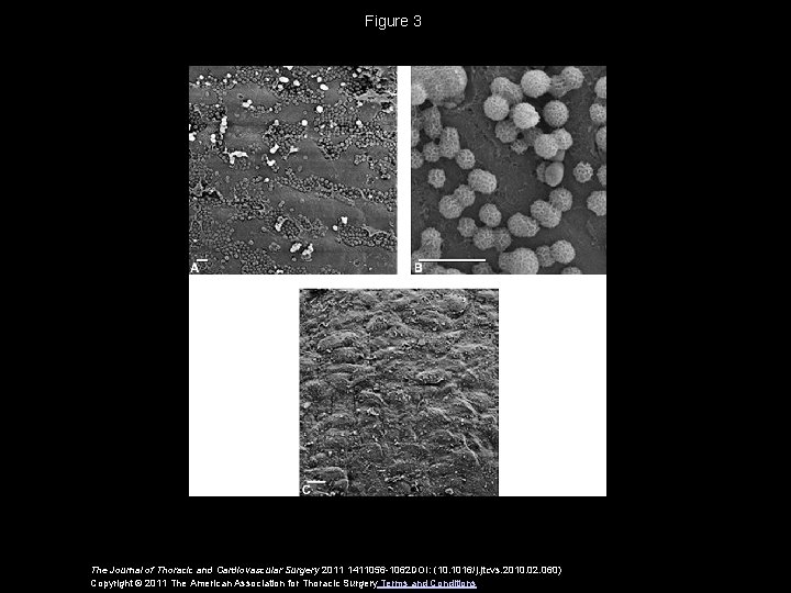 Figure 3 The Journal of Thoracic and Cardiovascular Surgery 2011 1411056 -1062 DOI: (10.