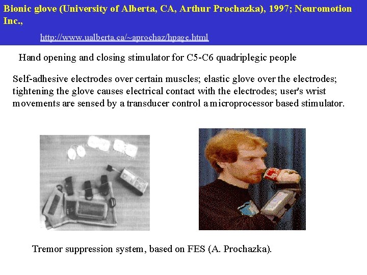 Bionic glove (University of Alberta, CA, Arthur Prochazka), 1997; Neuromotion Inc. , http: //www. Bionic glove (University of Alberta, CA, Arthur Prochazka), 1997; Neuromotion Inc. , http: //www.