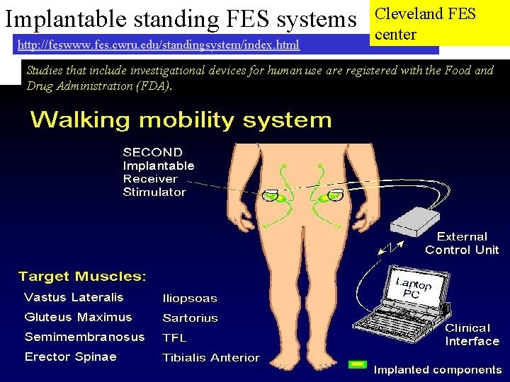 Implantable standing FES systems http: //feswww. fes. cwru. edu/standingsystem/index. html Cleveland FES center Studies Implantable standing FES systems http: //feswww. fes. cwru. edu/standingsystem/index. html Cleveland FES center Studies
