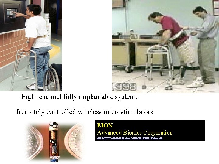 Eight channel fully implantable system. Remotely controlled wireless microstimulators BION Advanced Bionics Corporation http: Eight channel fully implantable system. Remotely controlled wireless microstimulators BION Advanced Bionics Corporation http: