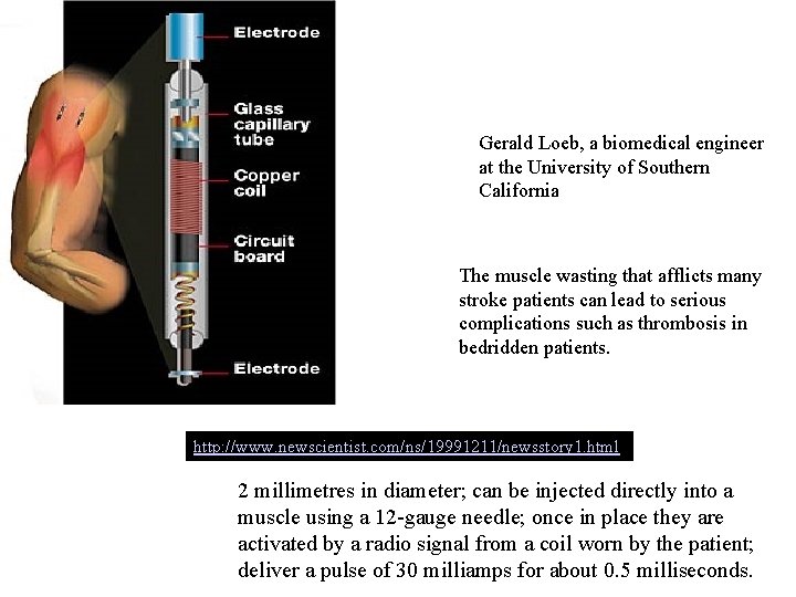 Gerald Loeb, a biomedical engineer at the University of Southern California The muscle wasting Gerald Loeb, a biomedical engineer at the University of Southern California The muscle wasting