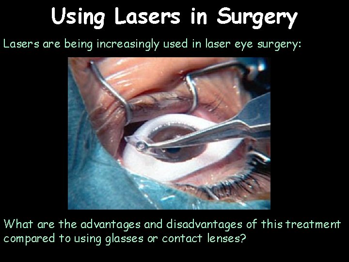 Using Lasers in Surgery Lasers are being increasingly used in laser eye surgery: What