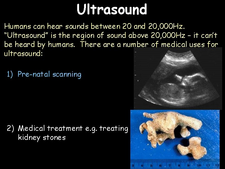 Ultrasound Humans can hear sounds between 20 and 20, 000 Hz. “Ultrasound” is the
