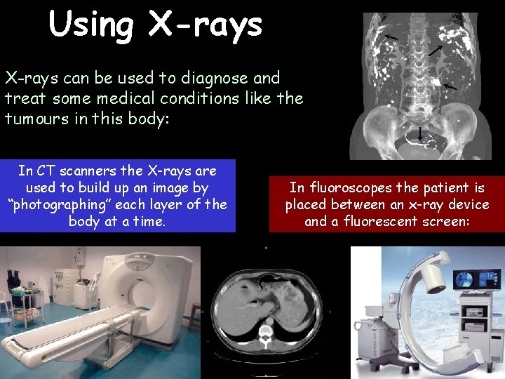 Using X-rays can be used to diagnose and treat some medical conditions like the