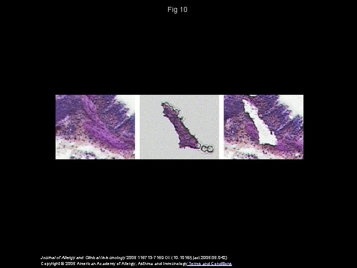 Fig 10 Journal of Allergy and Clinical Immunology 2005 116713 -716 DOI: (10. 1016/j.