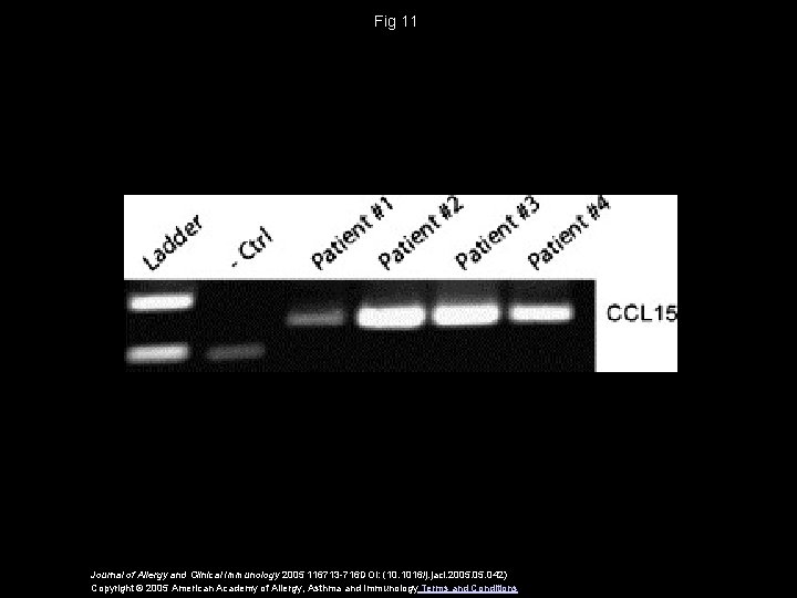 Fig 11 Journal of Allergy and Clinical Immunology 2005 116713 -716 DOI: (10. 1016/j.