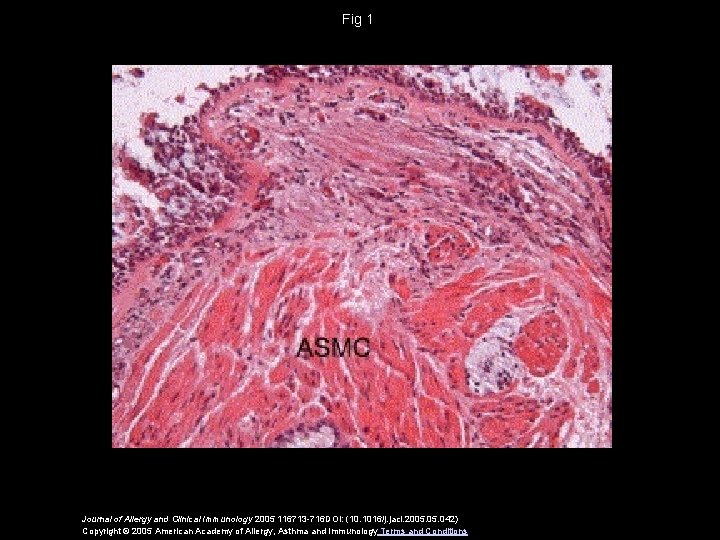 Fig 1 Journal of Allergy and Clinical Immunology 2005 116713 -716 DOI: (10. 1016/j.