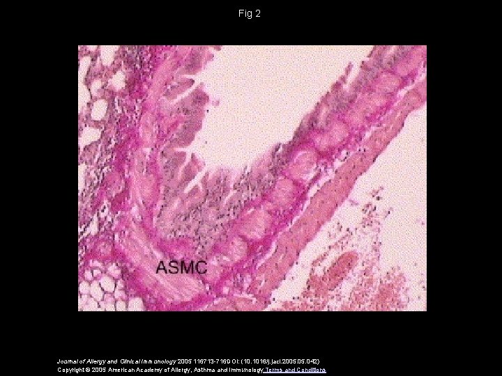 Fig 2 Journal of Allergy and Clinical Immunology 2005 116713 -716 DOI: (10. 1016/j.