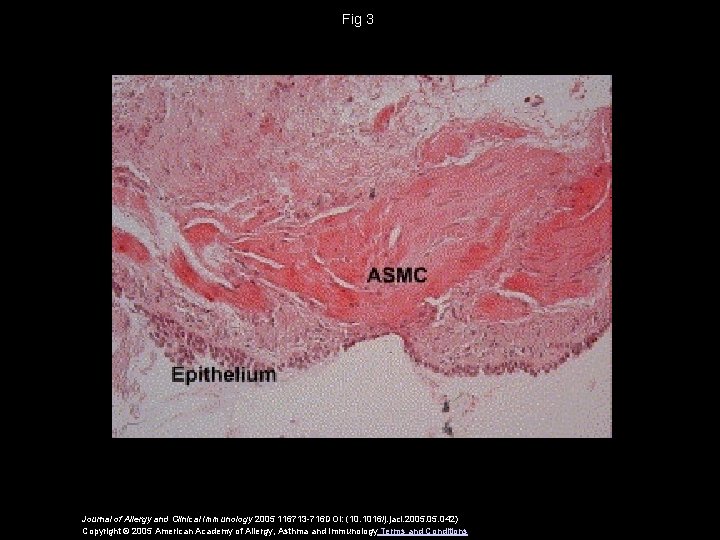 Fig 3 Journal of Allergy and Clinical Immunology 2005 116713 -716 DOI: (10. 1016/j.