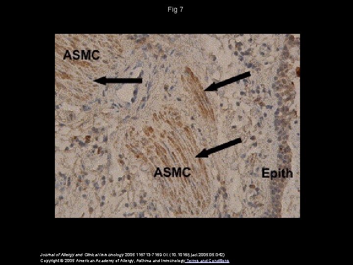 Fig 7 Journal of Allergy and Clinical Immunology 2005 116713 -716 DOI: (10. 1016/j.