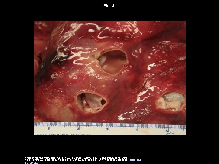 Fig. 4 Clinical Microbiology and Infection 2015 21426 -432 DOI: (10. 1016/j. cmi. 2015.