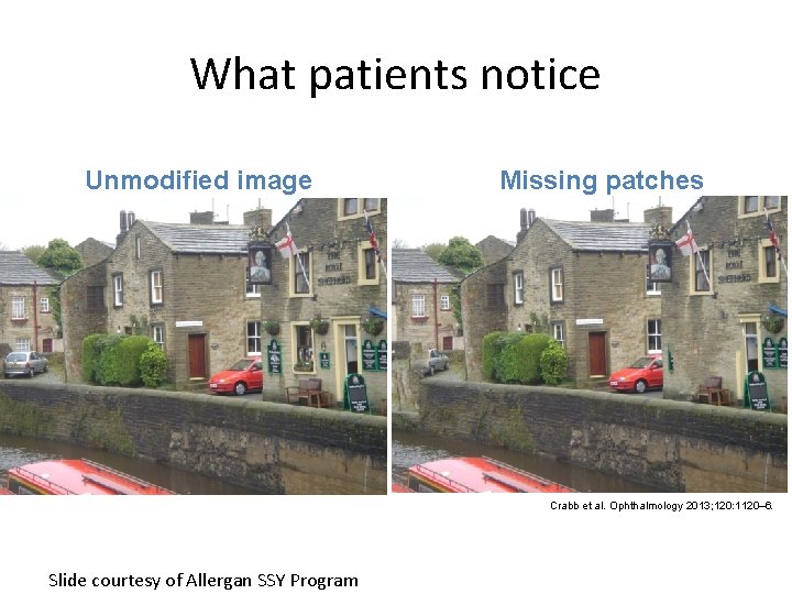 What patients notice Unmodified image Missing patches Crabb et al. Ophthalmology 2013; 120: 1120–