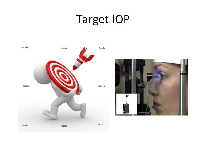 Target IOP 