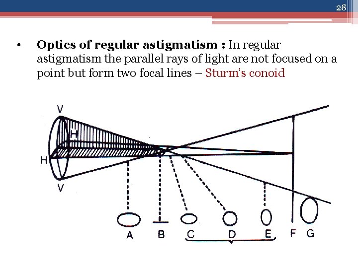 28 • Optics of regular astigmatism : In regular astigmatism the parallel rays of