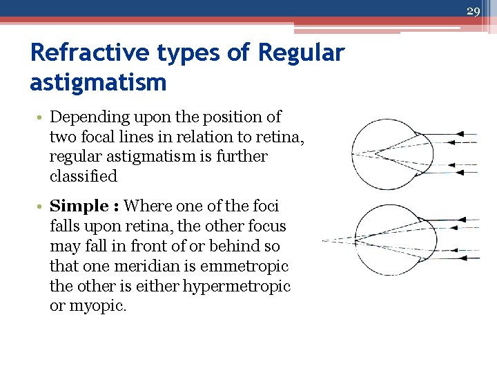 29 Refractive types of Regular astigmatism • Depending upon the position of two focal