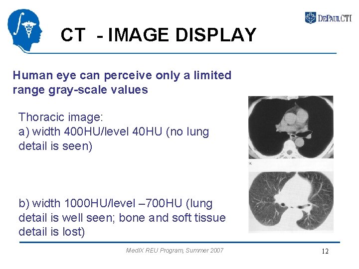 CT - IMAGE DISPLAY Human eye can perceive only a limited range gray-scale values