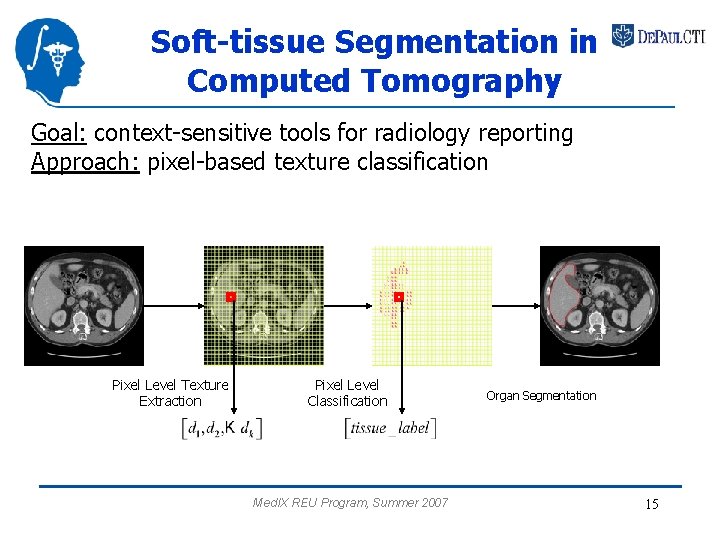 Soft-tissue Segmentation in Computed Tomography Goal: context-sensitive tools for radiology reporting Approach: pixel-based texture