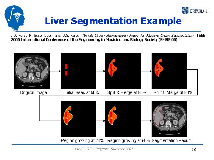 Liver Segmentation Example J. D. Furst, R. Susomboon, and D. S. Raicu, "Single Organ