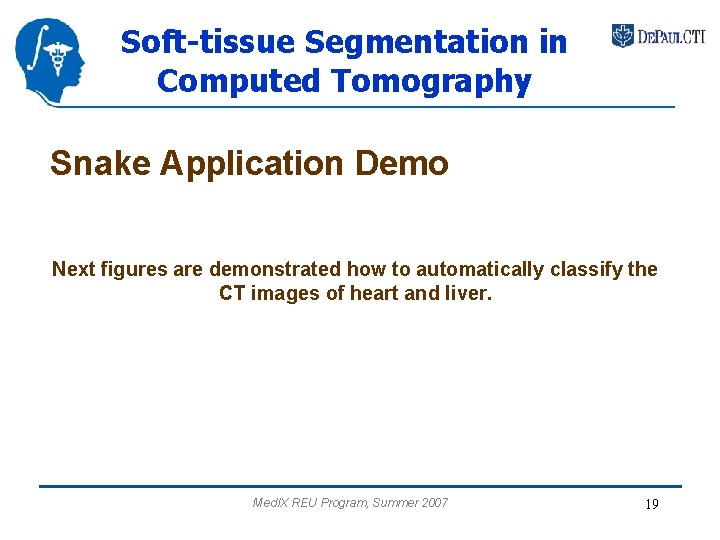 Soft-tissue Segmentation in Computed Tomography Snake Application Demo Next figures are demonstrated how to