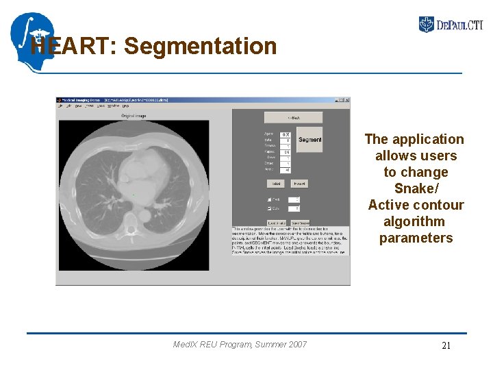 HEART: Segmentation The application allows users to change Snake/ Active contour algorithm parameters Med.