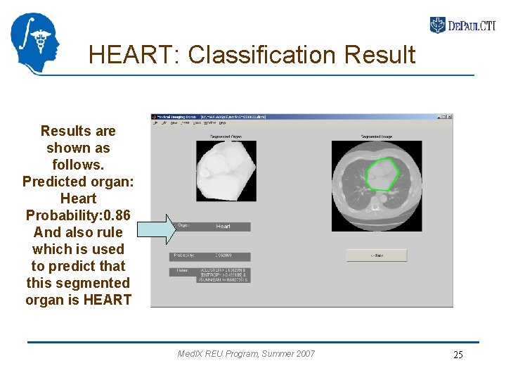 HEART: Classification Results are shown as follows. Predicted organ: Heart Probability: 0. 86 And