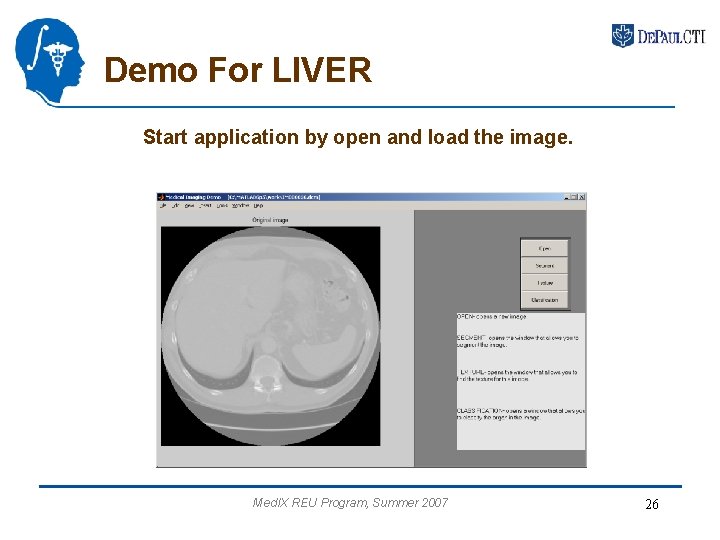 Demo For LIVER Start application by open and load the image. Med. IX REU