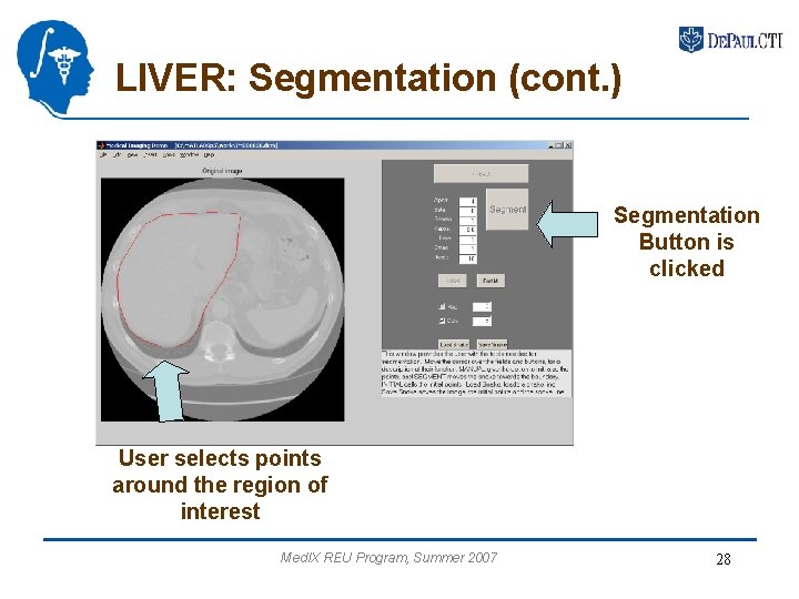 LIVER: Segmentation (cont. ) Segmentation Button is clicked User selects points around the region