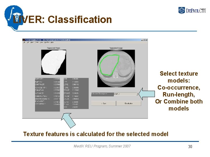 LIVER: Classification Select texture models: Co-occurrence, Run-length, Or Combine both models Texture features is