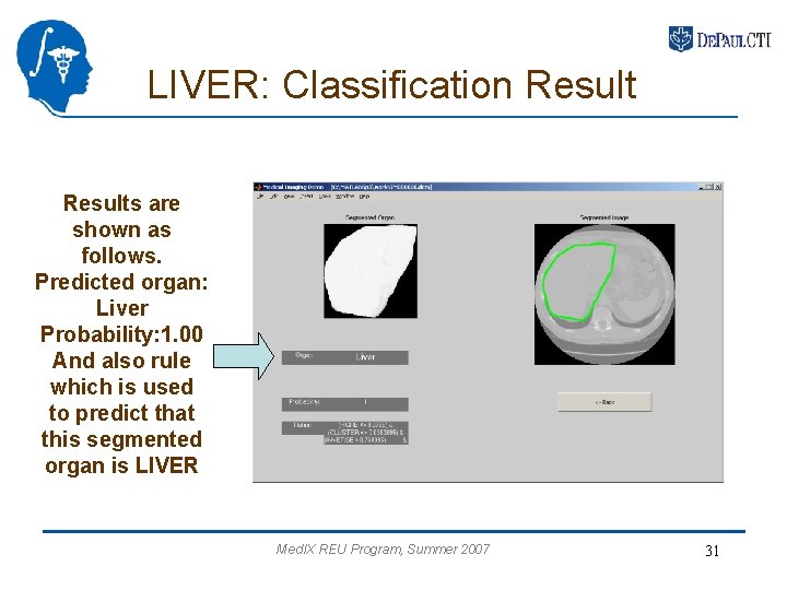 LIVER: Classification Results are shown as follows. Predicted organ: Liver Probability: 1. 00 And