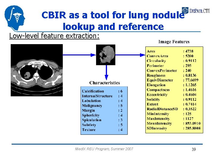 CBIR as a tool for lung nodule lookup and reference Low-level feature extraction: Med.