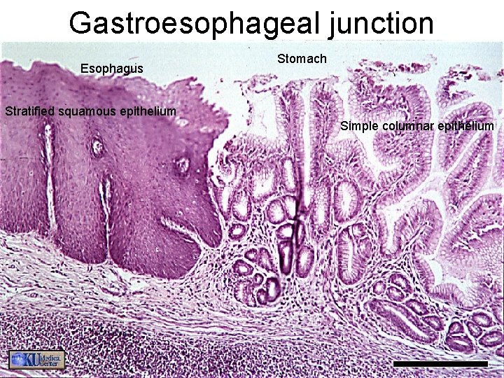 Gastroesophageal junction Esophagus Stomach Stratified squamous epithelium Simple columnar epithelium 