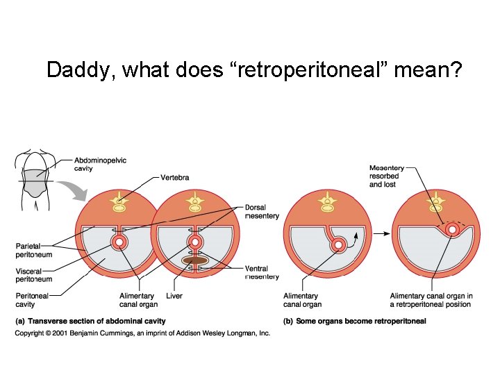 Daddy, what does “retroperitoneal” mean? 
