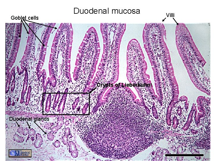 Goblet cells Duodenal mucosa Crypts of Lieberkuhn! Duodenal glands Villi 