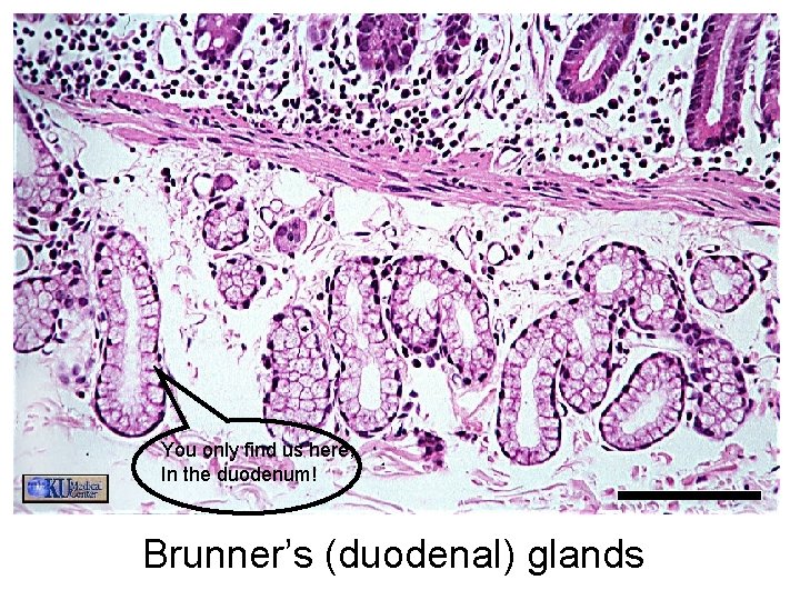 You only find us here, In the duodenum! Brunner’s (duodenal) glands 