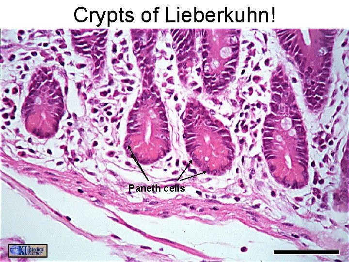 Crypts of Lieberkuhn! Paneth cells 