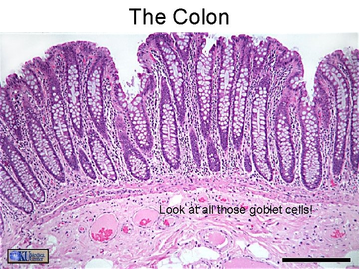 The Colon Look at all those goblet cells! 