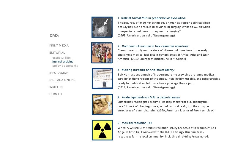 PRINT xx EDIT articles top 1. Role of breast MRI in preoperative evaluation DRD