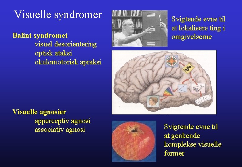 Visuelle syndromer Balint syndromet visuel desorientering optisk ataksi okulomotorisk apraksi Visuelle agnosier apperceptiv agnosi