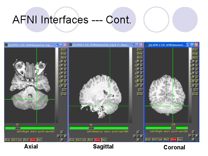 AFNI Interfaces --- Cont. Axial Sagittal Coronal 