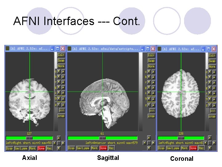 AFNI Interfaces --- Cont. Axial Sagittal Coronal 