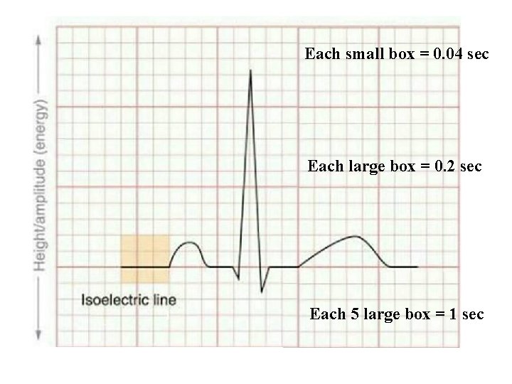 Each small box = 0. 04 sec Each large box = 0. 2 sec