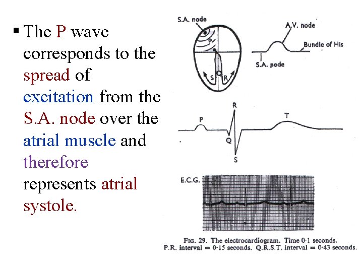 § The P wave corresponds to the spread of excitation from the S. A.