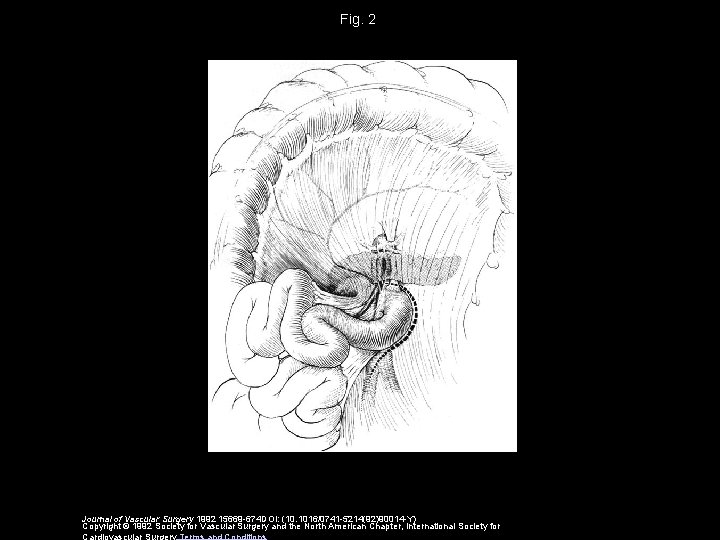 Fig. 2 Journal of Vascular Surgery 1992 15669 -674 DOI: (10. 1016/0741 -5214(92)90014 -Y)