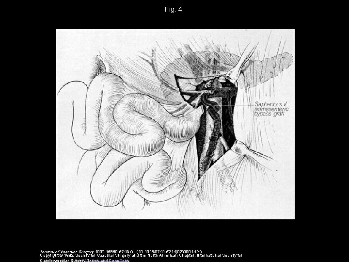 Fig. 4 Journal of Vascular Surgery 1992 15669 -674 DOI: (10. 1016/0741 -5214(92)90014 -Y)