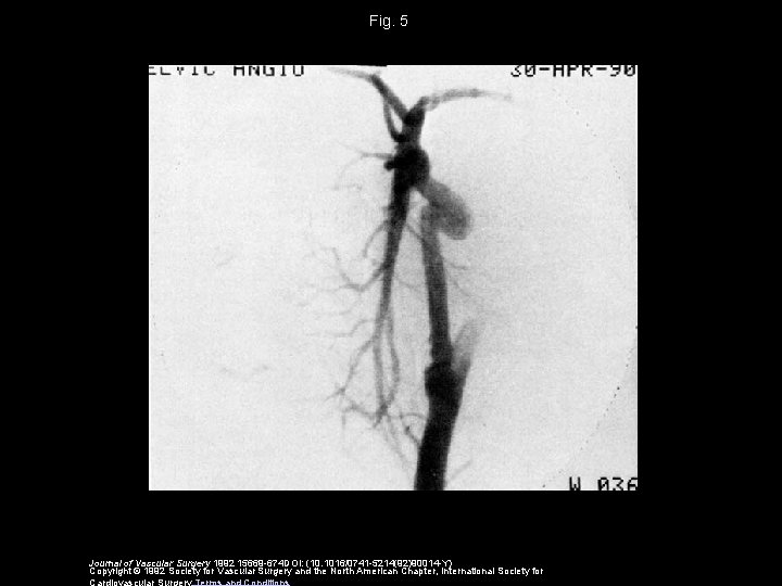 Fig. 5 Journal of Vascular Surgery 1992 15669 -674 DOI: (10. 1016/0741 -5214(92)90014 -Y)