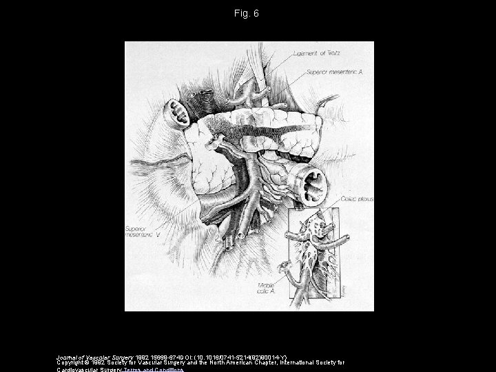 Fig. 6 Journal of Vascular Surgery 1992 15669 -674 DOI: (10. 1016/0741 -5214(92)90014 -Y)